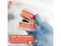 best-orthodontist-in-dubai-small-0