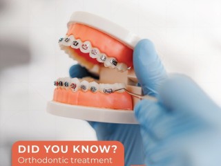 Best orthodontist in Dubai