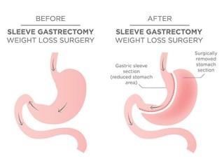 Comprehensive Obesity Treatment at Our Leading Clinic