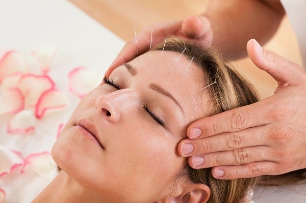 facial-acupuncture-nyc-big-0