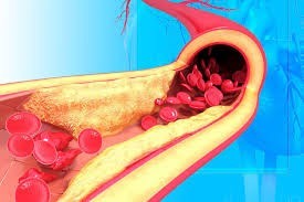 rosuvastatin-a-medicine-to-treat-high-cholesterol-big-0