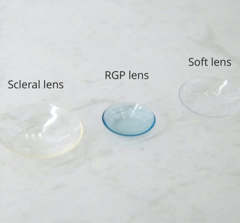 rgp-contact-lenses-specialists-in-dubai-enhance-your-vision-with-expert-care-big-0