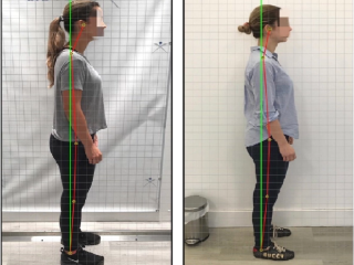 Upper Back Posture Correction in NYC - Kang Chiropractic