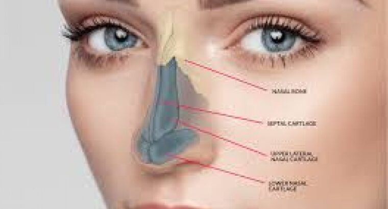 Nasal Valve Collapse and Surgical Solutions: What Patients Should Know