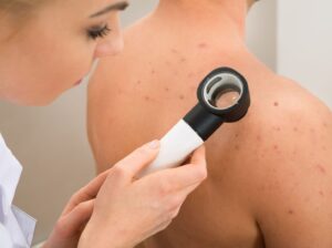 Best Dermatologist Near You for Skin Checks