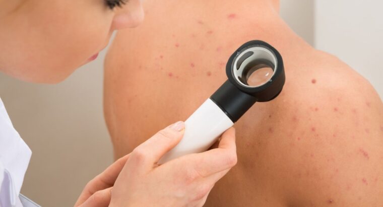 Best Dermatologist Near You for Skin Checks