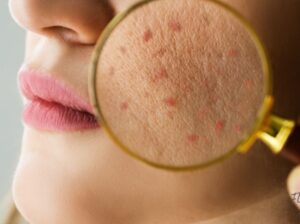 Flawless4ever Skin & Hair Clinic in Kharadi