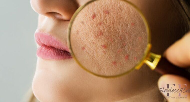 Flawless4ever Skin & Hair Clinic in Kharadi