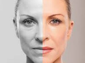 Facial Liposuction in El Segundo: Effective Fat Reduction with Minimal Downtime