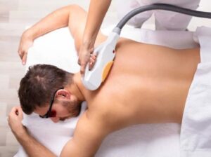 Laser Hair Removal For Guys