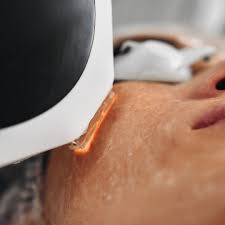 Best Home Cold Laser