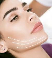 How***Can***I***Minimize***Scarring***After***Facelift***Surgery***in***Dubai?