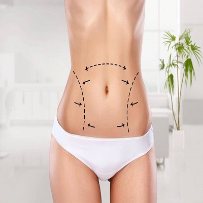 Can***Vaser***Liposuction***in***Dubai***Reduce***Fat***in***Hard-to-Treat***Areas***Like***Arms***or***Back?