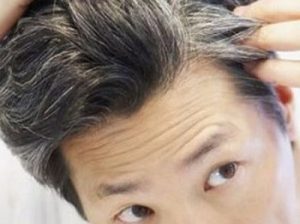 Is***There***Any***Downtime***After***White***Hair***Removal***Sessions?