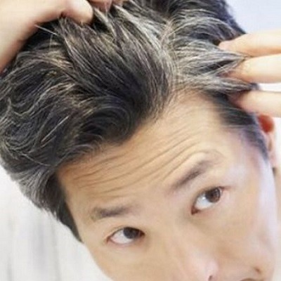 Is***There***Any***Downtime***After***White***Hair***Removal***Sessions?