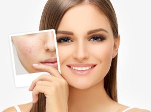 Can***Laser***Treatments***Help***Reduce***Redness***and***Inflammation***of***Scars***in***Dubai?