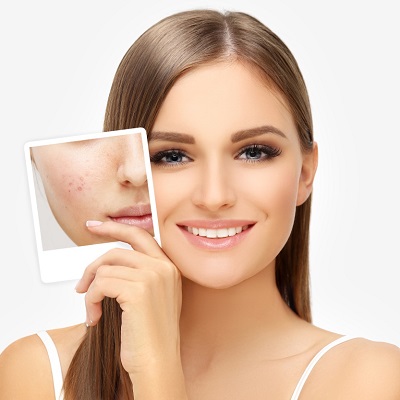 Can***Laser***Treatments***Help***Reduce***Redness***and***Inflammation***of***Scars***in***Dubai?