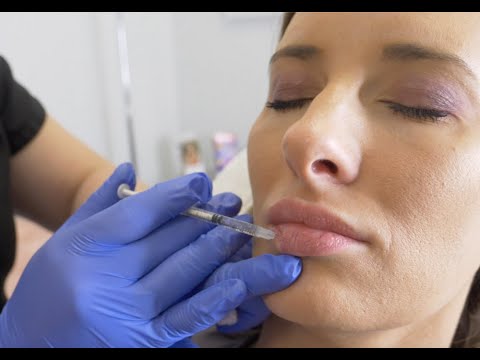 How***Can***I***Maintain***My***Lip***Filler***Results***in***Dubai?