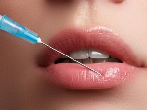 Are***there***non-invasive***alternatives***to***lip***filler***injections?