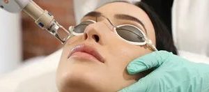 How***Should***I***Care***for***My***Skin***After***Laser***Treatment***in***Dubai?