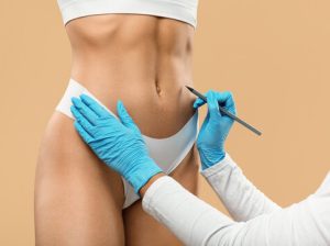 What***Are***the***Common***Side***Effects***of***Liposuction***in***Dubai?