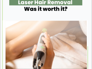 Laser***Hair***Removal – Smooth***Skin***Without***Daily***Drama
