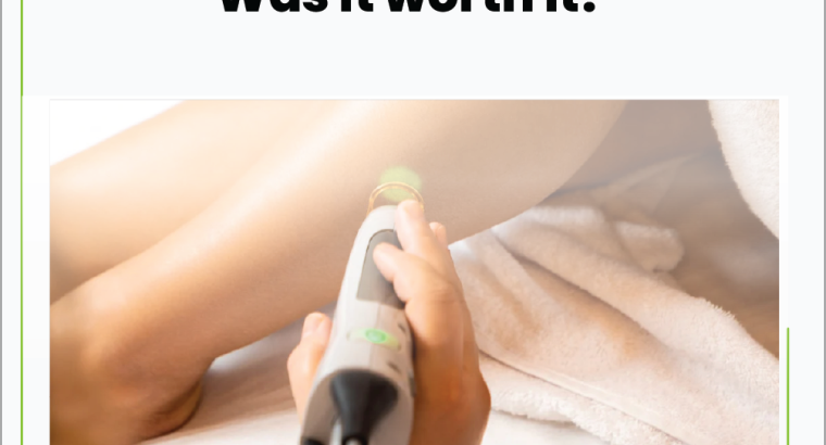 Laser***Hair***Removal – Smooth***Skin***Without***Daily***Drama