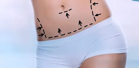 Are***non-surgical***fat***reduction***options***in***Dubai***better***than***liposuction?