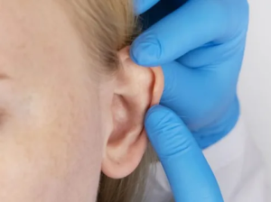 Is***ear***lobe***correction***surgery***covered***by***insurance***in***Dubai?