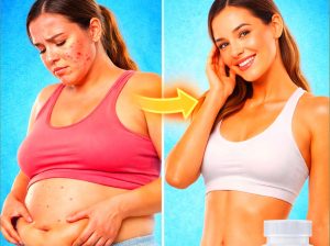 Always***Bloated, Gaining***Weight & Breaking***Out? Read***This