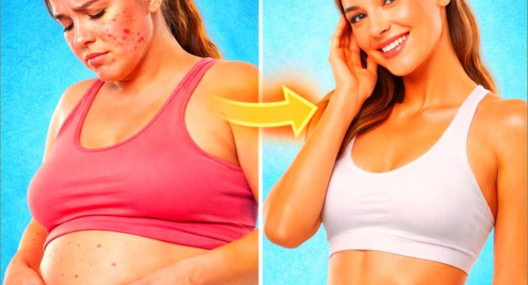 Always***Bloated, Gaining***Weight & Breaking***Out? Read***This